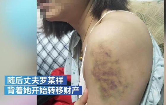微视频｜四川广元女子公开视频 称遭丈夫家暴16年