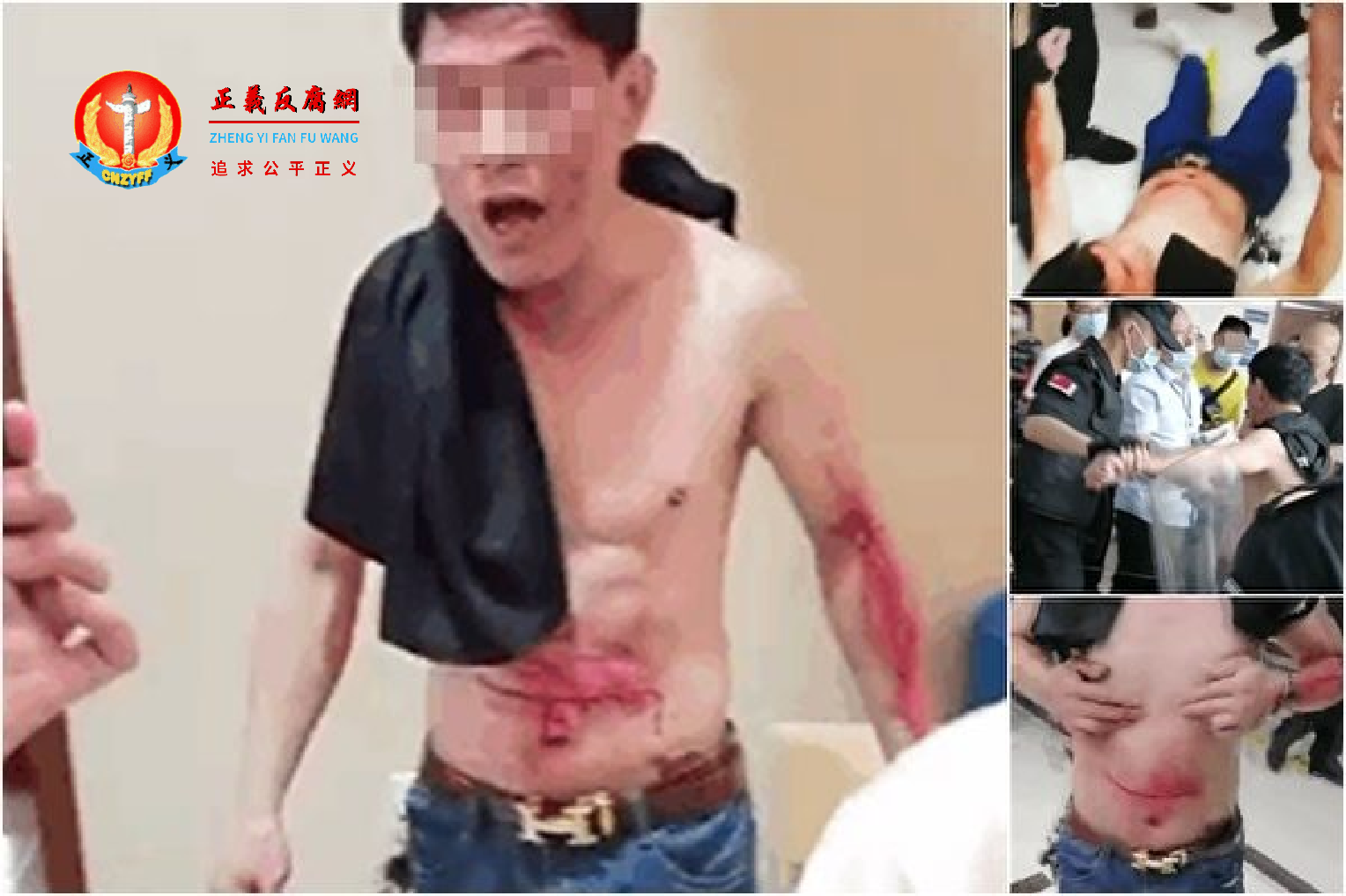 6月21日上午，被“工龄归零”停发退休金的陆忠友在重庆市九龙坡区社保局大厅挥刀割腹、割腕自杀，当场被紧急送医。.png
