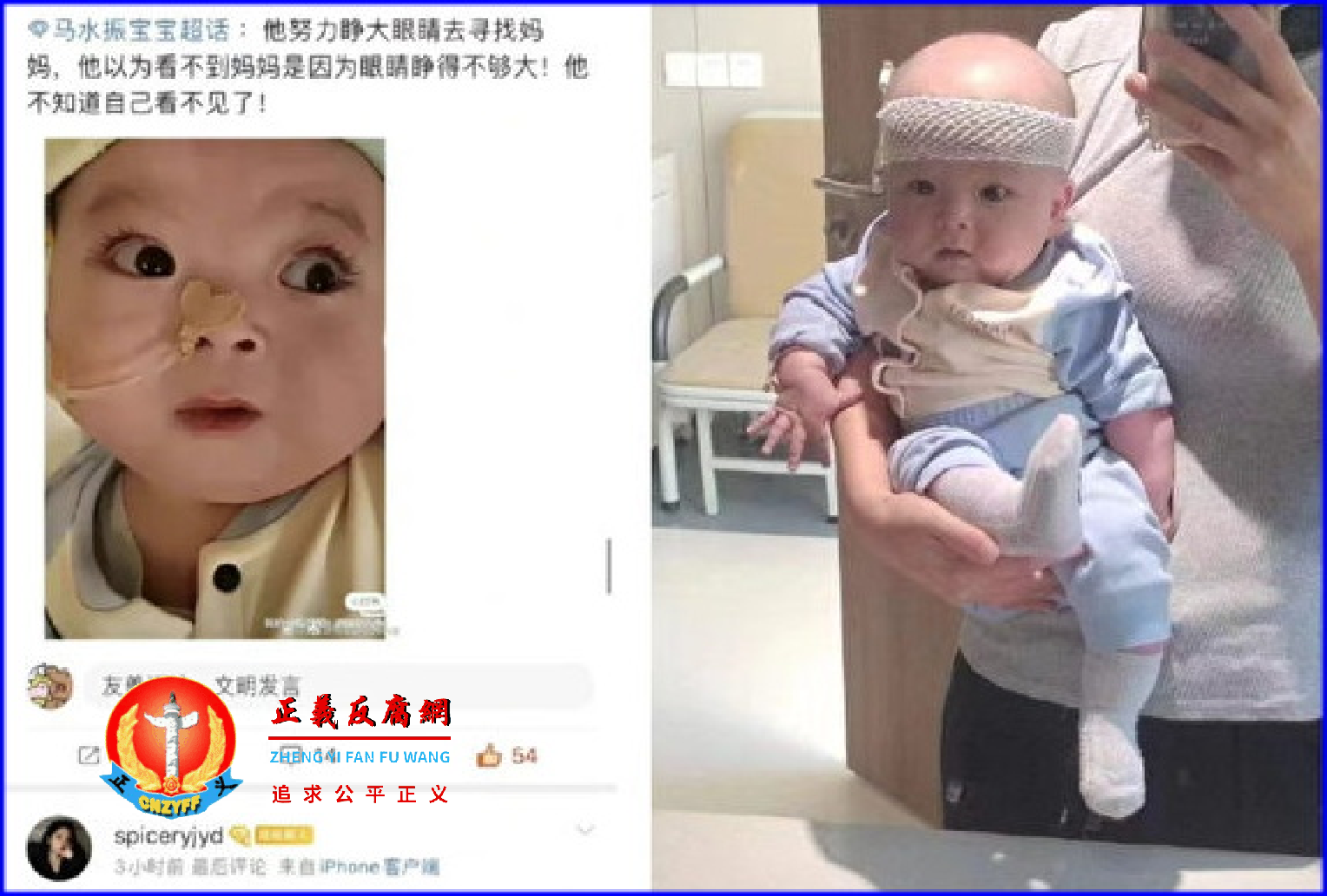 微视频｜甘肃4个月小宝宝术后失明，家属讨说法被打压