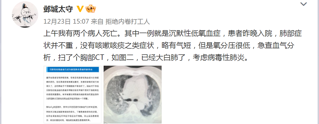 患者入院，扫了个胸部CT，已经大白肺了，考虑病毒性肺炎。..png