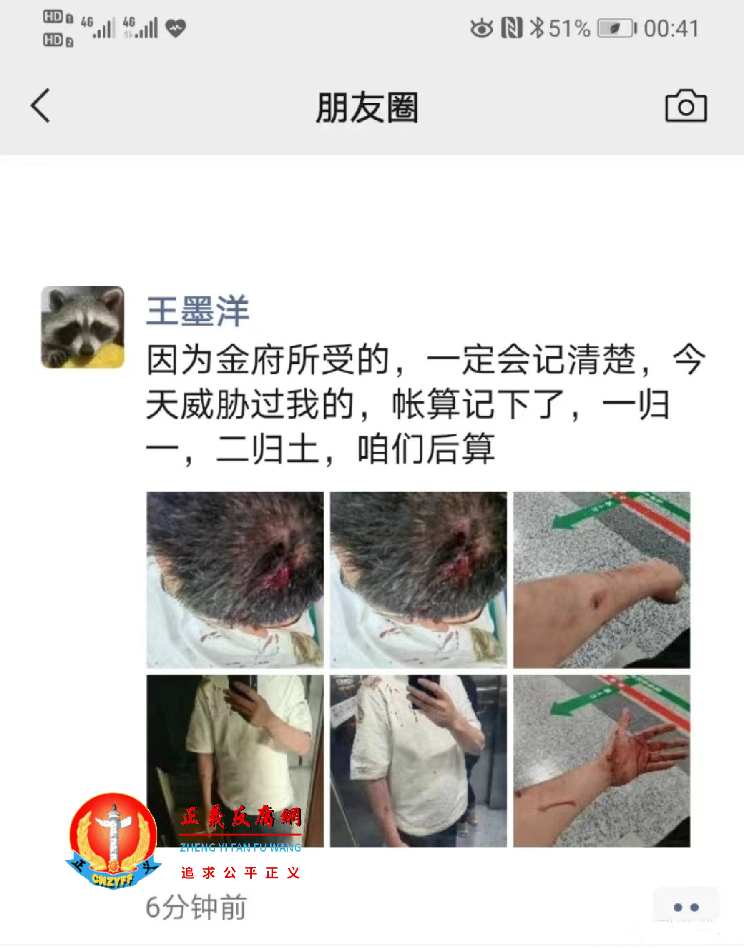 王墨洋在微信朋友圈群中上传了自己被打伤的图片和在医院缝合伤口的视频片段.png