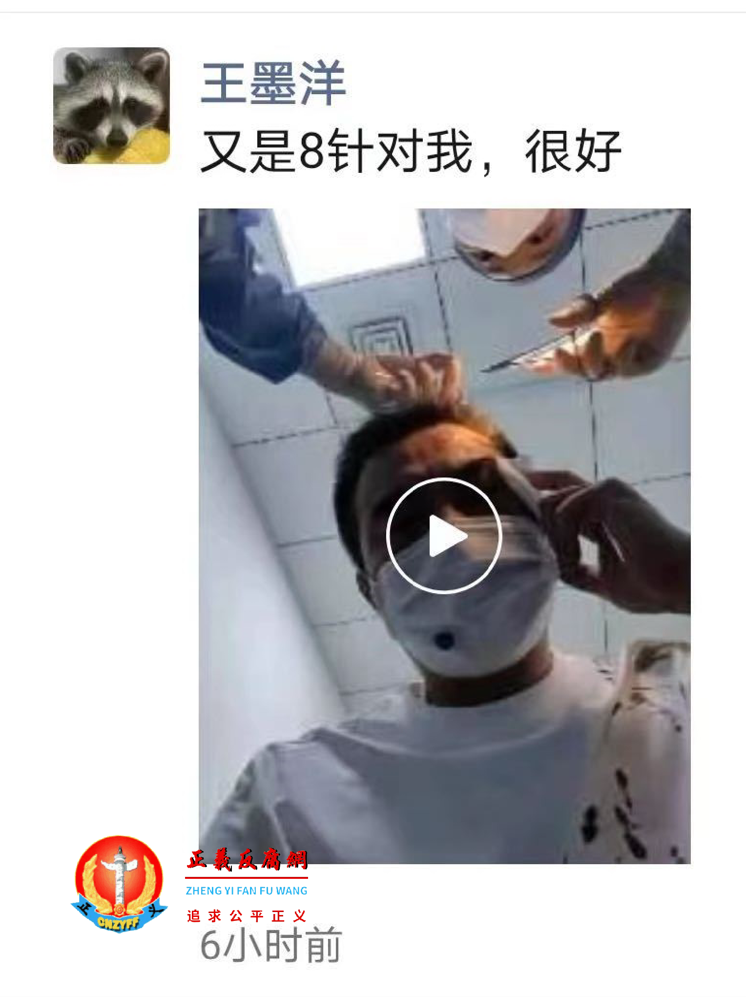 王墨洋在微信朋友圈群中上传了自己被打伤的图片和在医院缝合伤口的视频片段..png